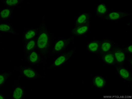 [10105-2-AP-20UL] UBE2T/HSPC150 Polyclonal antibody