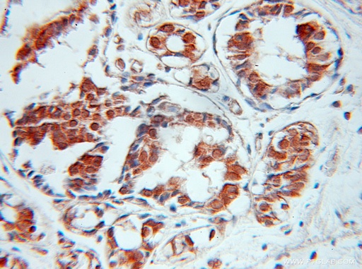 [10107-2-AP-20UL] SPIN2B Polyclonal antibody