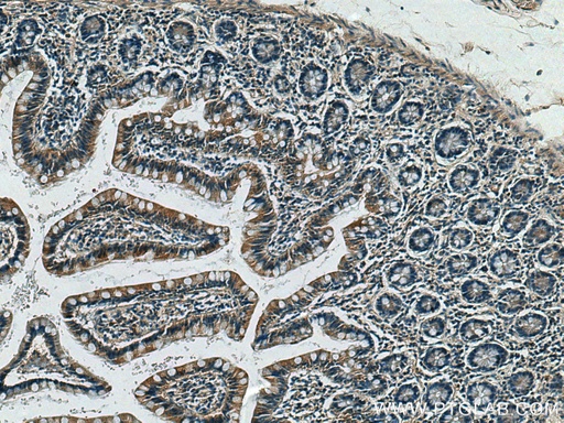 [10108-2-AP-20UL] CX3CL1 Polyclonal antibody