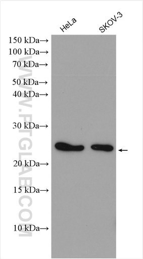 [10113-2-AP-150UL] LDOC1 Polyclonal antibody
