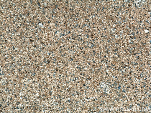 [10116-1-AP-150UL] GDI2 Polyclonal antibody