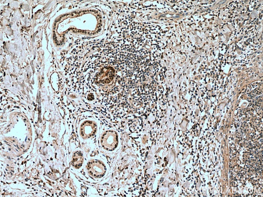 [10119-1-AP-20UL] CORO2A Polyclonal antibody