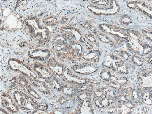 [10121-2-AP-150UL] ICAM2 Polyclonal antibody