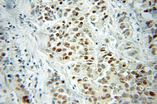 [10124-2-AP-20UL] VGLL1 Polyclonal antibody