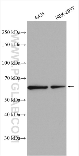 [10126-2-AP-150UL] CPNE1 Polyclonal antibody