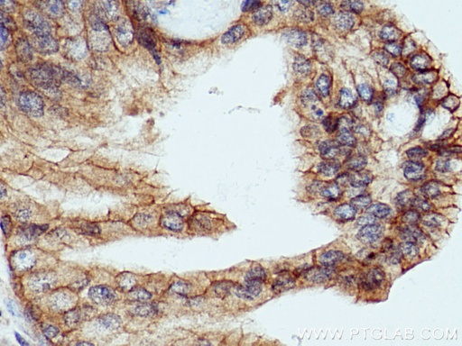 [10128-2-AP-150UL] LRRC1 Polyclonal antibody