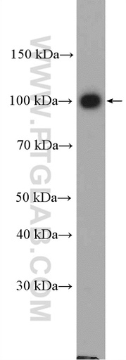 [10130-1-AP-150UL] Adaptin Polyclonal antibody