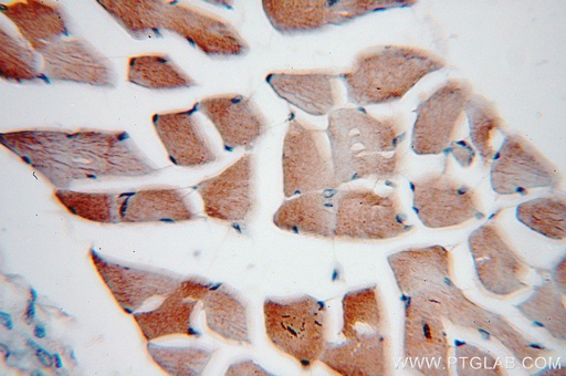 [10135-1-AP-20UL] VAMP2 Polyclonal antibody