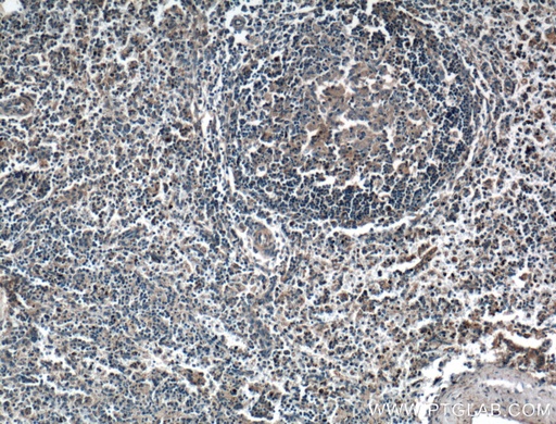 [10138-1-AP-20UL] HVEM/TNFRSF14 Polyclonal antibody