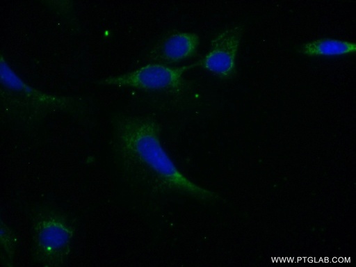 [10140-2-AP-150UL] PPP1CB-Specific Polyclonal antibody