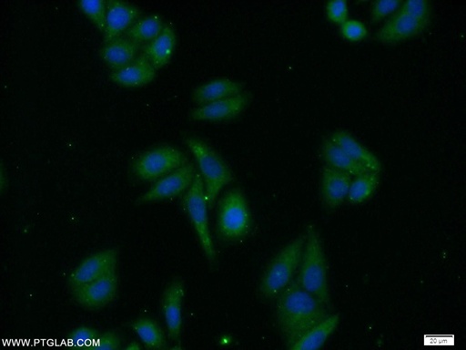 [10146-2-AP-20UL] PREB Polyclonal antibody