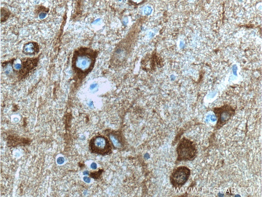 [10149-1-AP-150UL] NSE Polyclonal antibody