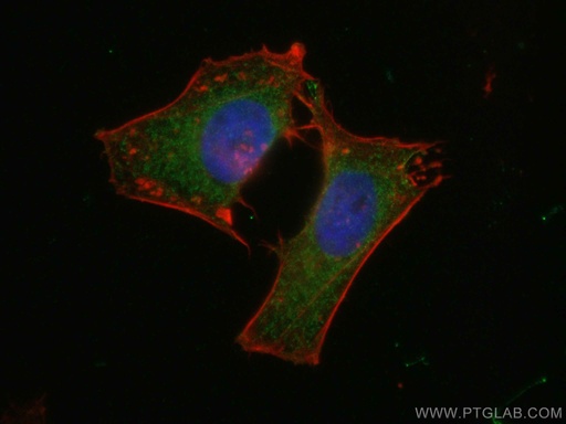 [10150-2-AP-150UL] GNAS Polyclonal antibody