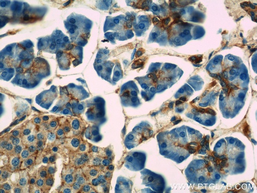 [10154-2-AP-150UL] Annexin VII Polyclonal antibody
