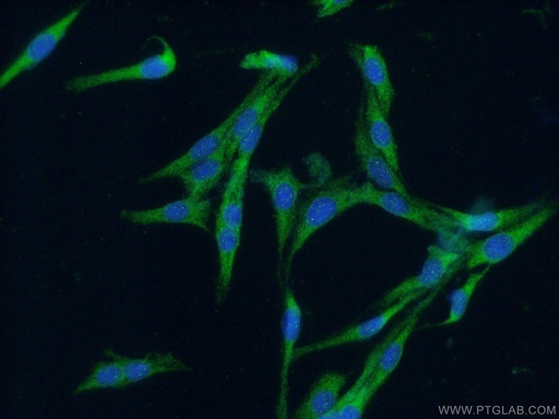 [10155-1-AP-150UL] CDC42 Polyclonal antibody