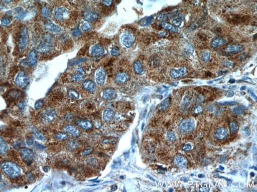 [10157-1-AP-20UL] TUSC4 Polyclonal antibody
