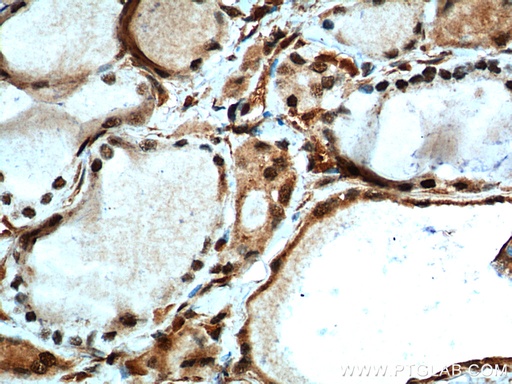 [10159-2-AP-150UL] MYCN Polyclonal antibody