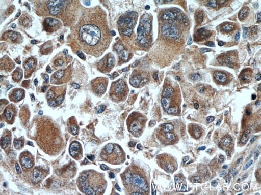 [10166-1-AP-20UL] DOPA decarboxylase Polyclonal antibody