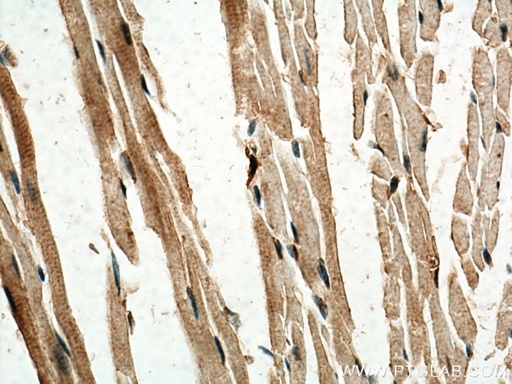 [10167-1-AP-150UL] SERTAD1 Polyclonal antibody