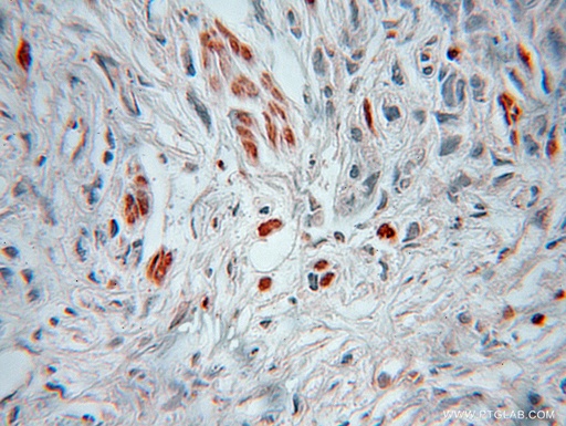 [10169-2-AP-150UL] HSBP1 Polyclonal antibody