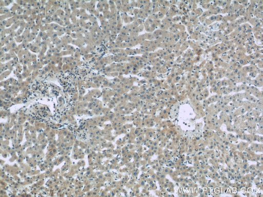 [10170-1-AP-20UL] Complement factor B Polyclonal antibody