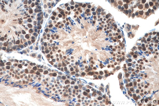 [10173-1-AP-20UL] GTF2H1 Polyclonal antibody