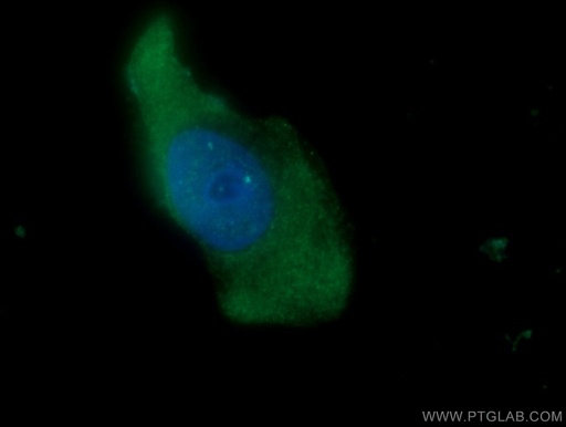 [10174-1-AP-150UL] NKIRAS2 Polyclonal antibody