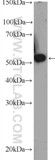 [10177-2-AP-20UL] TBRG4 Polyclonal antibody