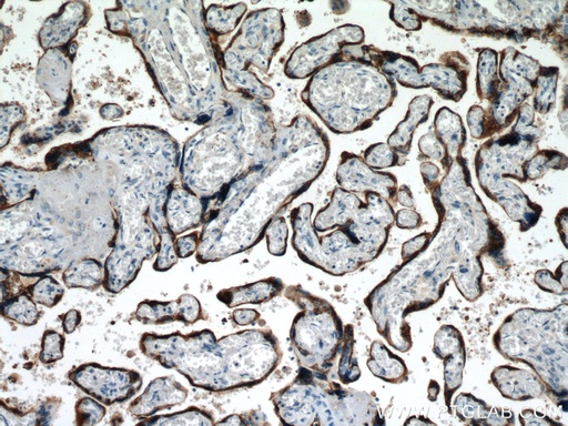 [10178-1-AP-150UL] Placental lactogen Polyclonal antibody