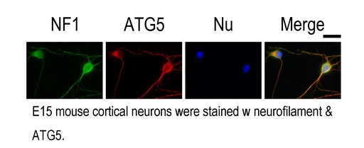[10181-2-AP-150UL] ATG5 Polyclonal antibody