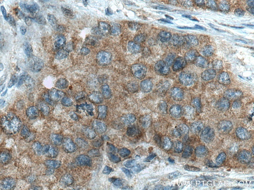 [10182-1-AP-150UL] DCTN5 Polyclonal antibody