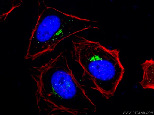 [10187-2-AP-150UL] RAB6A Polyclonal antibody