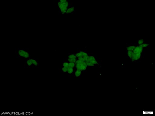 [10191-2-AP-20UL] DFF45/DFFA Polyclonal antibody