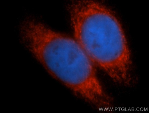 [10193-2-AP-20UL] RCN2 Polyclonal antibody
