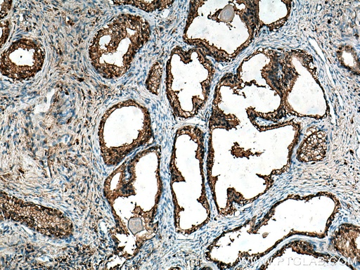 [10194-1-AP-150UL] CAPG Polyclonal antibody