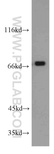 [10196-1-AP-20UL] RBM14 Polyclonal antibody