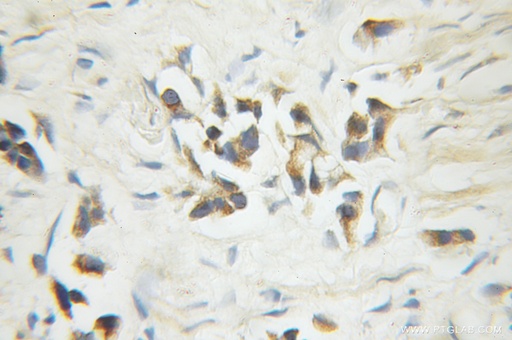 [10198-1-AP-20UL] Caspase 6/p18/p11 Polyclonal antibody
