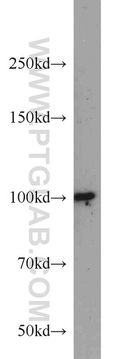 [10199-2-AP-150UL] DDX23 Polyclonal antibody
