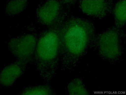 [10204-2-AP-20UL] DUSP11 Polyclonal antibody