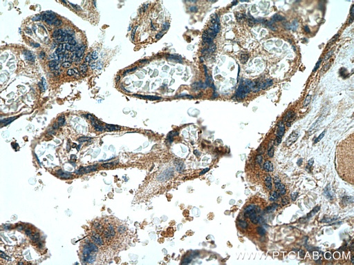 [10206-1-AP-20UL] NCK2 Polyclonal antibody