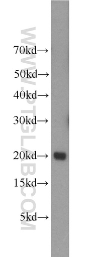 [10207-2-AP-150UL] UBE2V1 Polyclonal antibody