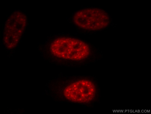 [10208-1-AP-150UL] EFTUD2 Polyclonal antibody