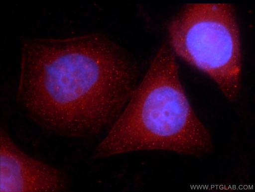 [10209-2-AP-20UL] CIRBP Polyclonal antibody