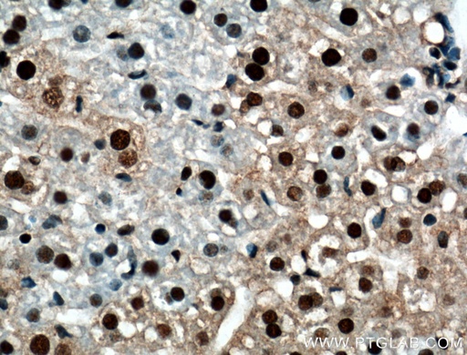[10210-2-AP-150UL] RUVBL1 Polyclonal antibody