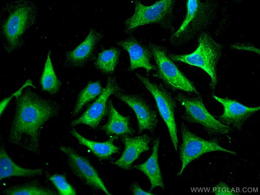 [10211-1-AP-150UL] HSPBP1 Polyclonal antibody