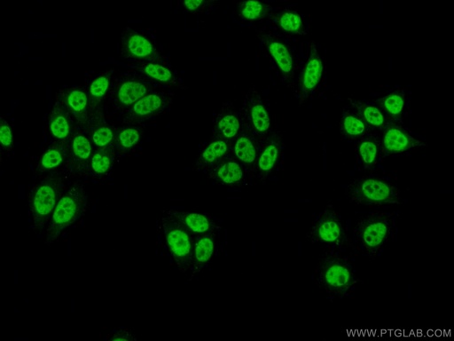 [10212-1-AP-150UL] SNRPA Polyclonal antibody
