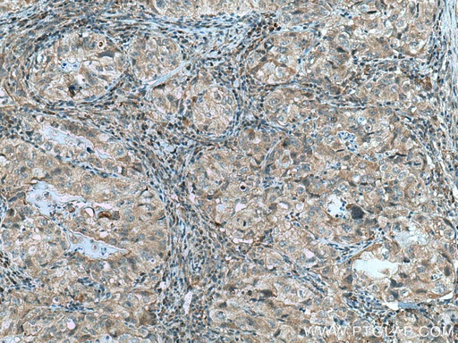 [10213-2-AP-150UL] RABEPK/p40 Polyclonal antibody