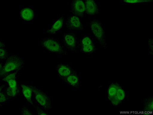 [10214-1-IG-150UL] TSC22D1 Polyclonal antibody