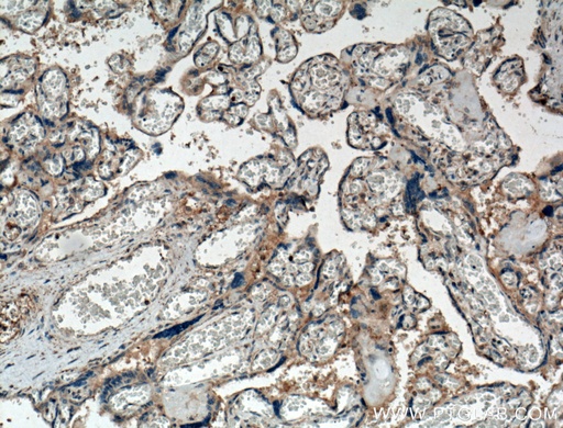 [10216-1-AP-150UL] Chemerin Polyclonal antibody