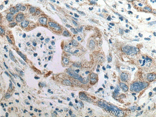[10217-1-AP-150UL] SAPK4 Polyclonal antibody